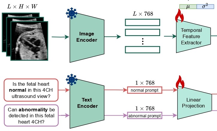 TPA architecture: fetal ultrasound frames and normal and abnormal text prompts encoded and projected into a shared space